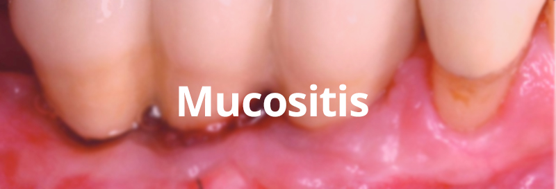 Mucositis